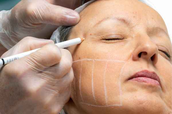 CryoPen: 5 Skin Concerns It May Be Used to Treat 4 What should you ask before having CryoPen treatment Derby?