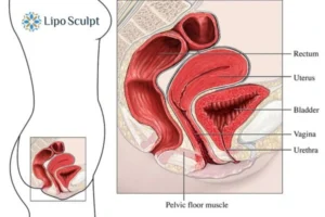Treatment For A Leaky Bladder 2 How EM Chair treatment Derby can help Leaky bladder issues. Read more now!